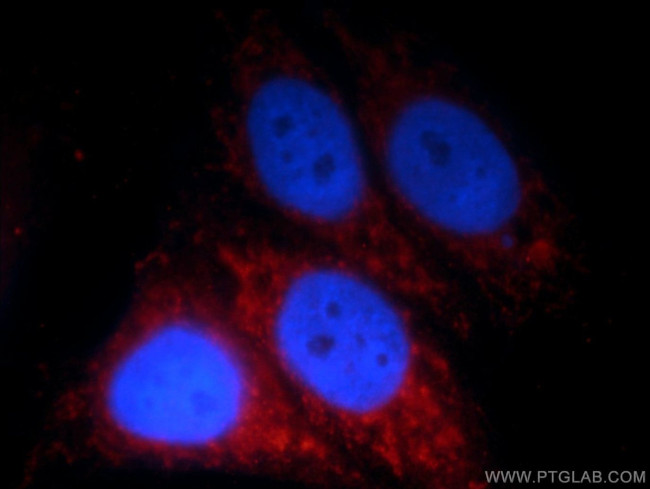 HPS4 Antibody in Immunocytochemistry (ICC/IF)