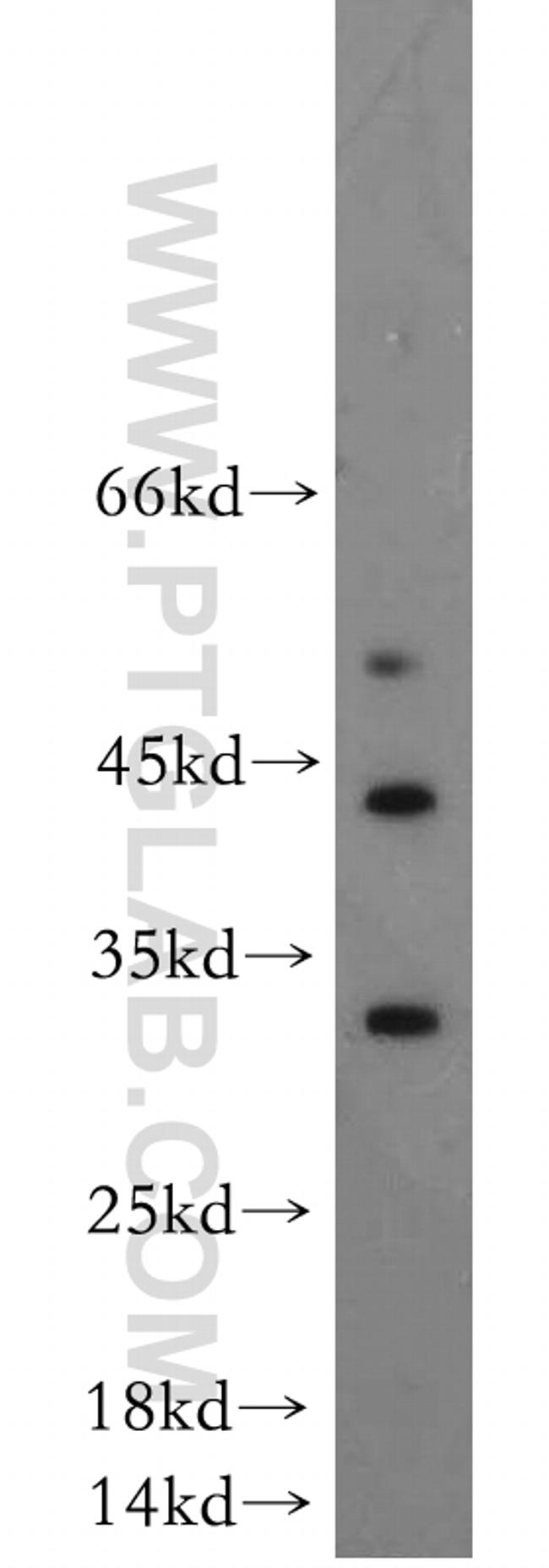 DUSP15 Antibody in Western Blot (WB)