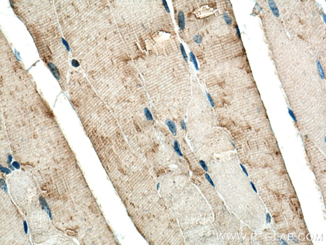 BIN1 Antibody in Immunohistochemistry (Paraffin) (IHC (P))
