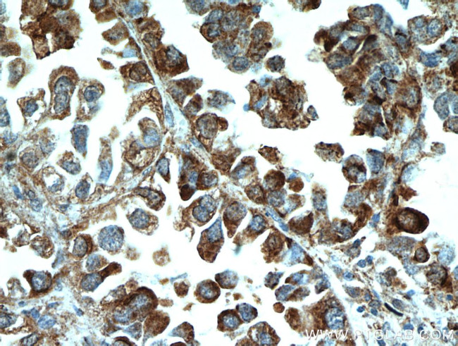 MPP3 Antibody in Immunohistochemistry (Paraffin) (IHC (P))