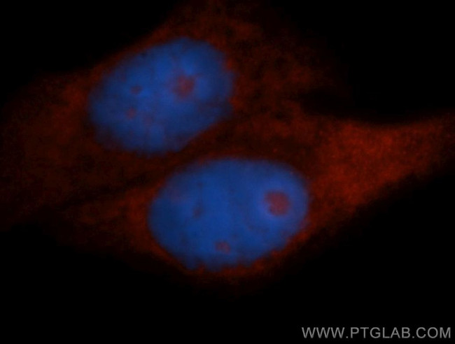 RPL18A Antibody in Immunocytochemistry (ICC/IF)