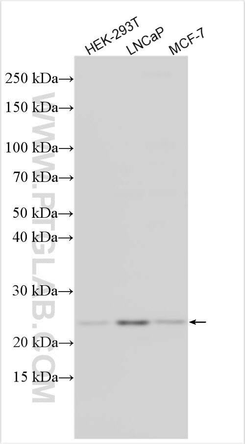 UFSP1 Antibody in Western Blot (WB)