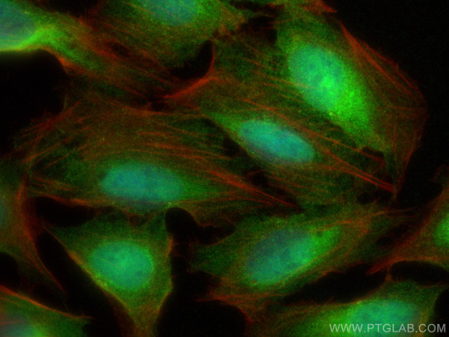 WIBG Antibody in Immunocytochemistry (ICC/IF)