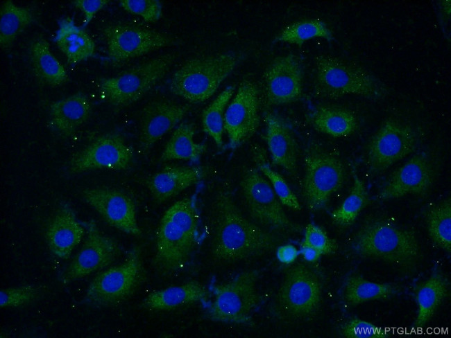 RPL37A Antibody in Immunocytochemistry (ICC/IF)