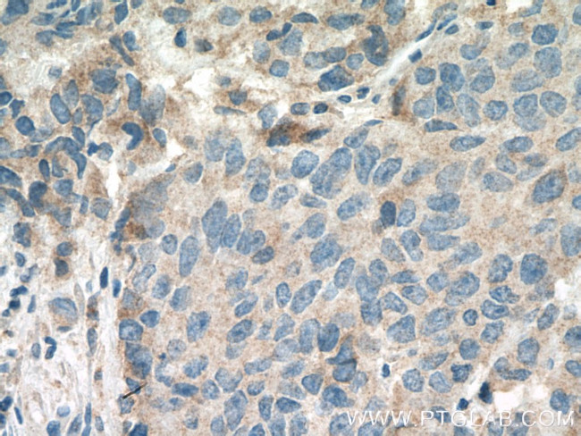 PHLDA2 Antibody in Immunohistochemistry (Paraffin) (IHC (P))