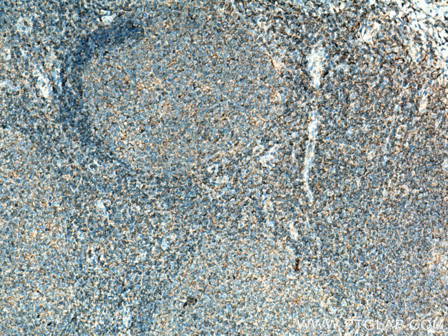 HLA-F Antibody in Immunohistochemistry (Paraffin) (IHC (P))