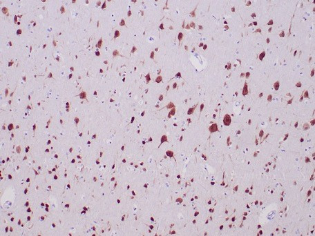 Neuronal-Nuclei (NeuN) (Neuronal Marker) Antibody in Immunohistochemistry (Paraffin) (IHC (P))