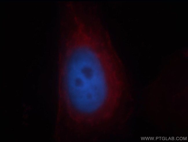 SEPT11 Antibody in Immunocytochemistry (ICC/IF)