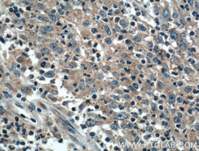 ADHFE1 Antibody in Immunohistochemistry (Paraffin) (IHC (P))