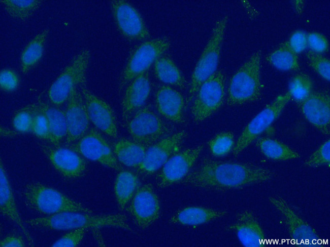 MRPL48 Antibody in Immunocytochemistry (ICC/IF)