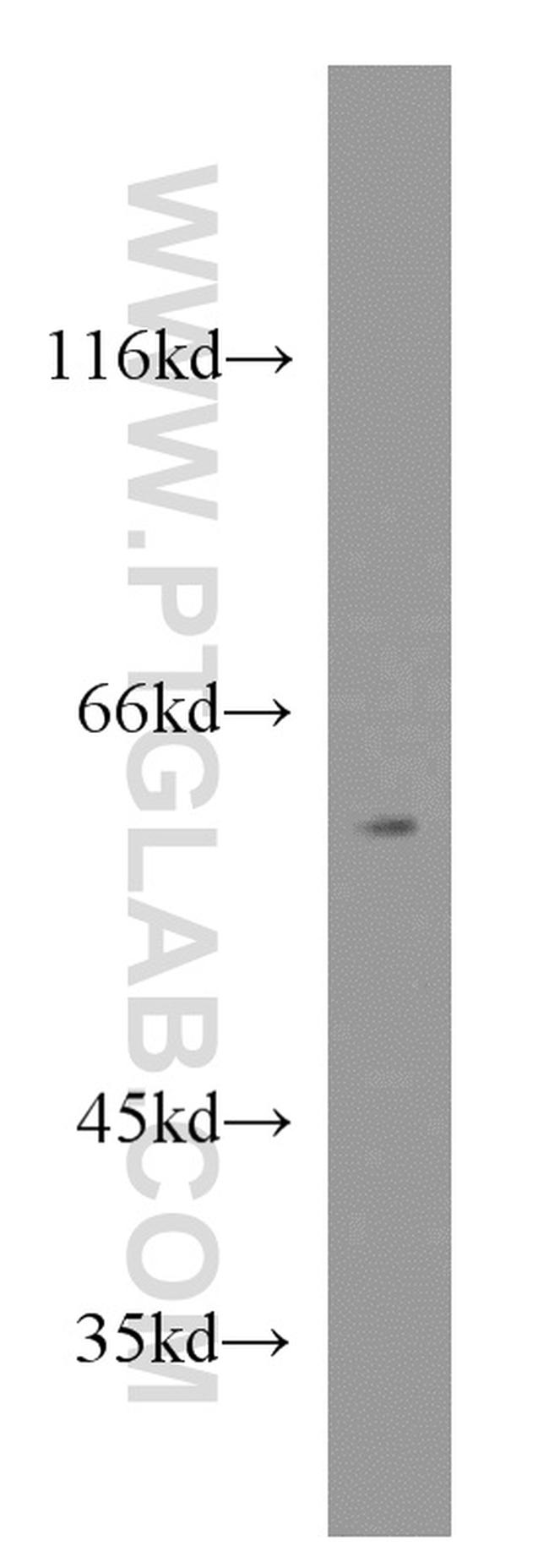 RXRB Antibody in Western Blot (WB)