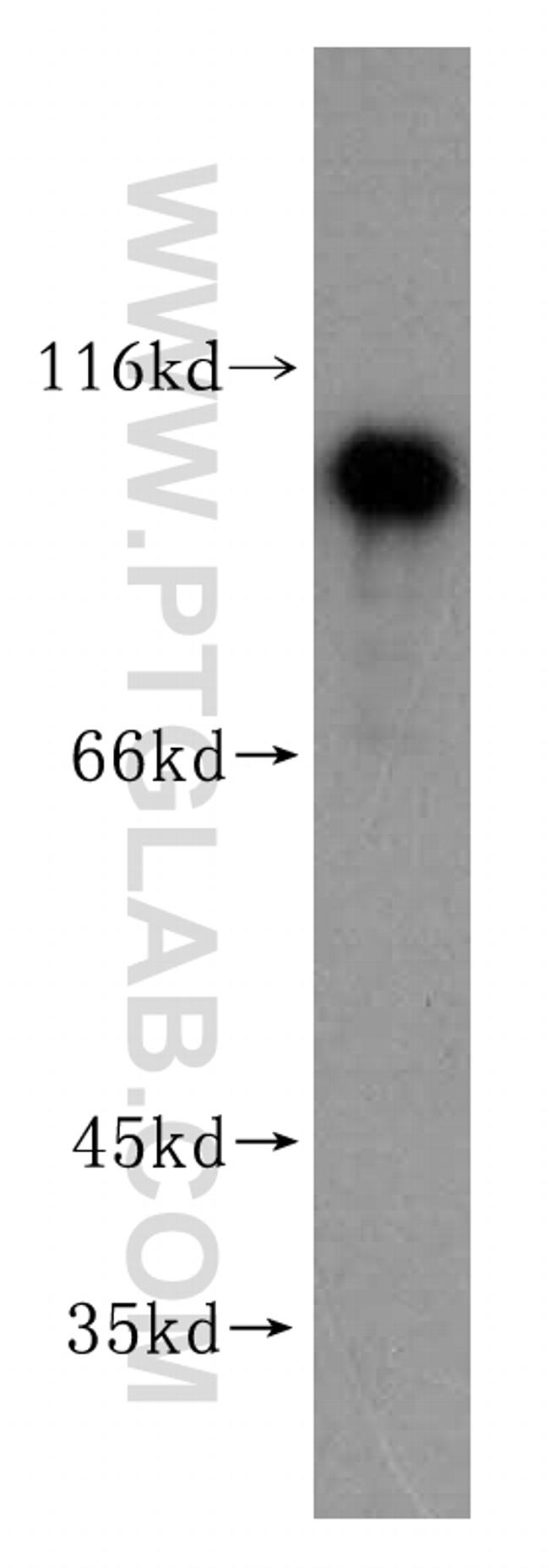 NKRF Antibody in Western Blot (WB)