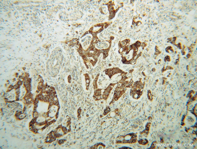AMN1 Antibody in Immunohistochemistry (Paraffin) (IHC (P))