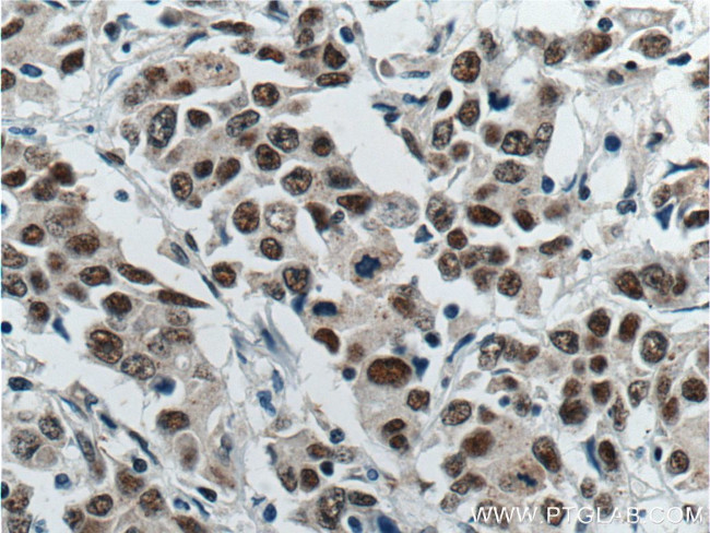 ATF7IP Antibody in Immunohistochemistry (Paraffin) (IHC (P))