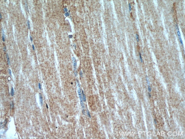 MAP4K3 Antibody in Immunohistochemistry (Paraffin) (IHC (P))