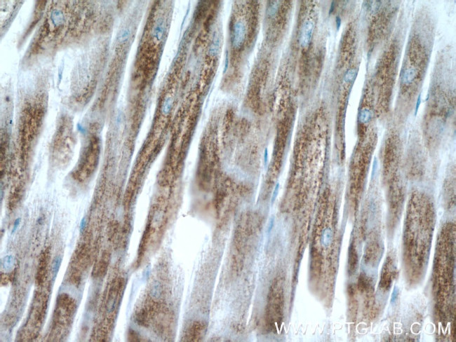 C14orf2 Antibody in Immunohistochemistry (Paraffin) (IHC (P))