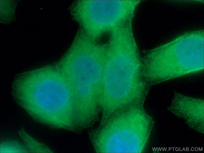UBXD1 Antibody in Immunocytochemistry (ICC/IF)