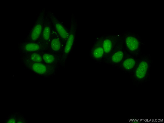 PAPSS1 Antibody in Immunocytochemistry (ICC/IF)
