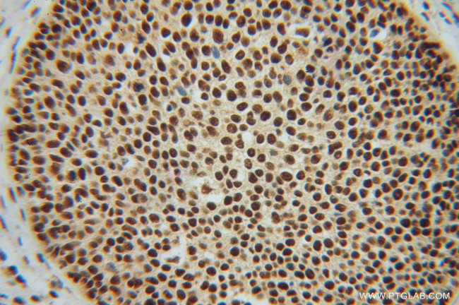 NF45 Antibody in Immunohistochemistry (Paraffin) (IHC (P))