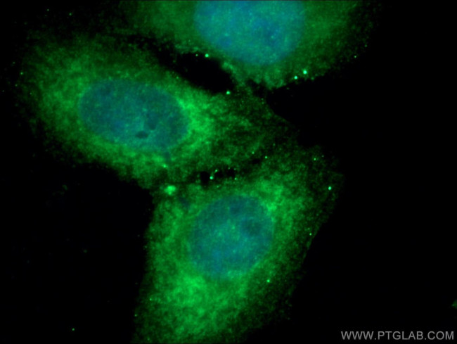 PHGDH Antibody in Immunocytochemistry (ICC/IF)