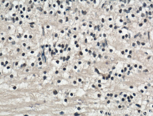TMEM98 Antibody in Immunohistochemistry (Paraffin) (IHC (P))