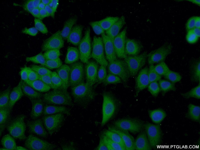 hD53/TPD52L1 Antibody in Immunocytochemistry (ICC/IF)