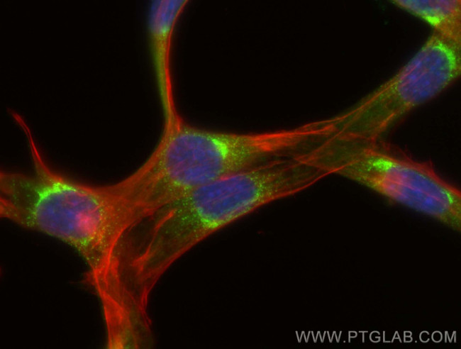 COPB2 Antibody in Immunocytochemistry (ICC/IF)
