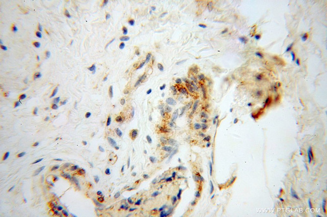 DEFB1 Antibody in Immunohistochemistry (Paraffin) (IHC (P))