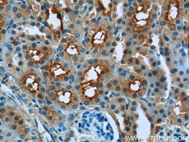 IVNS1ABP Antibody in Immunohistochemistry (Paraffin) (IHC (P))