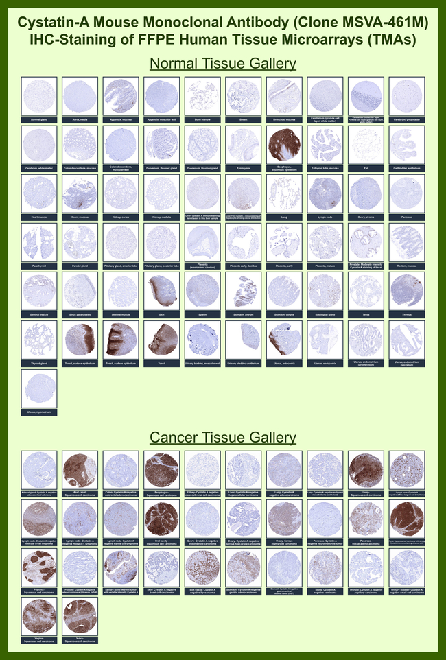 Cystatin A Antibody in Immunohistochemistry (Paraffin) (IHC (P))