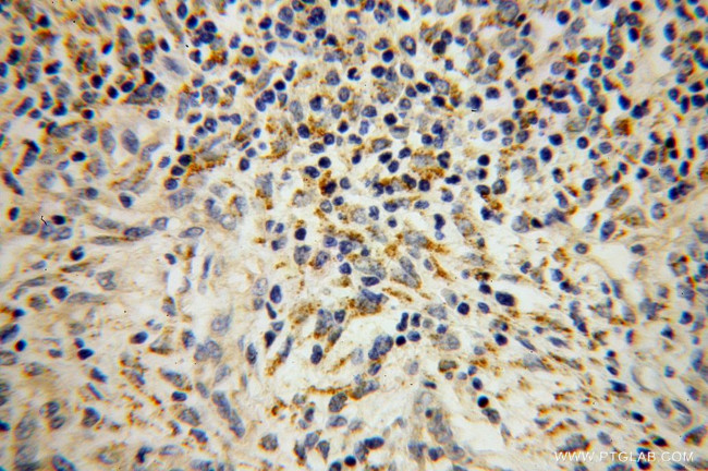 SEC11A Antibody in Immunohistochemistry (Paraffin) (IHC (P))