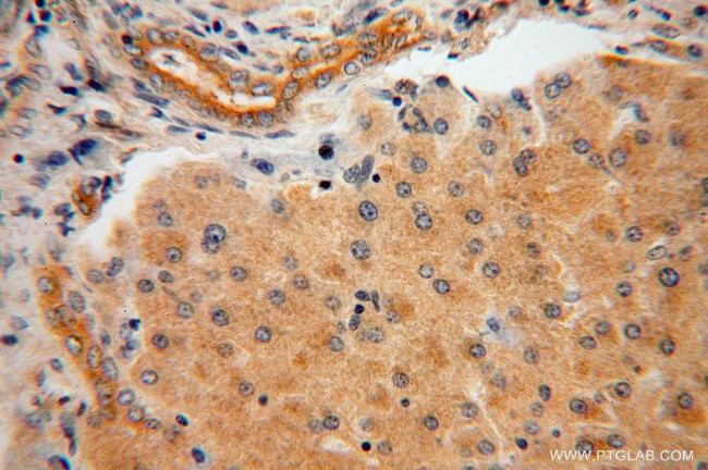 AARE Antibody in Immunohistochemistry (Paraffin) (IHC (P))