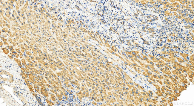 MRPL16 Antibody in Immunohistochemistry (Paraffin) (IHC (P))