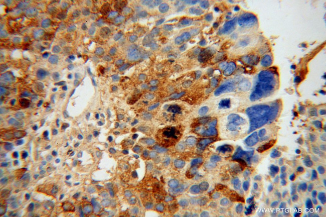 NLN Antibody in Immunohistochemistry (Paraffin) (IHC (P))
