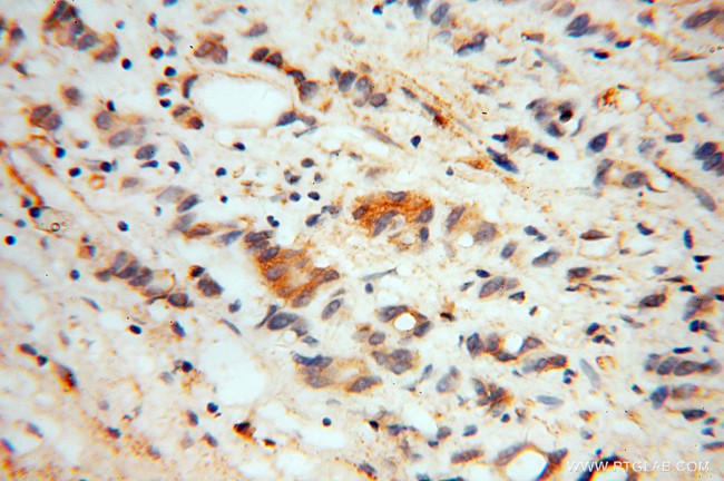 Noggin Antibody in Immunohistochemistry (Paraffin) (IHC (P))