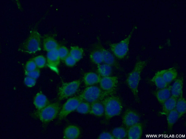 SEC22B Antibody in Immunocytochemistry (ICC/IF)