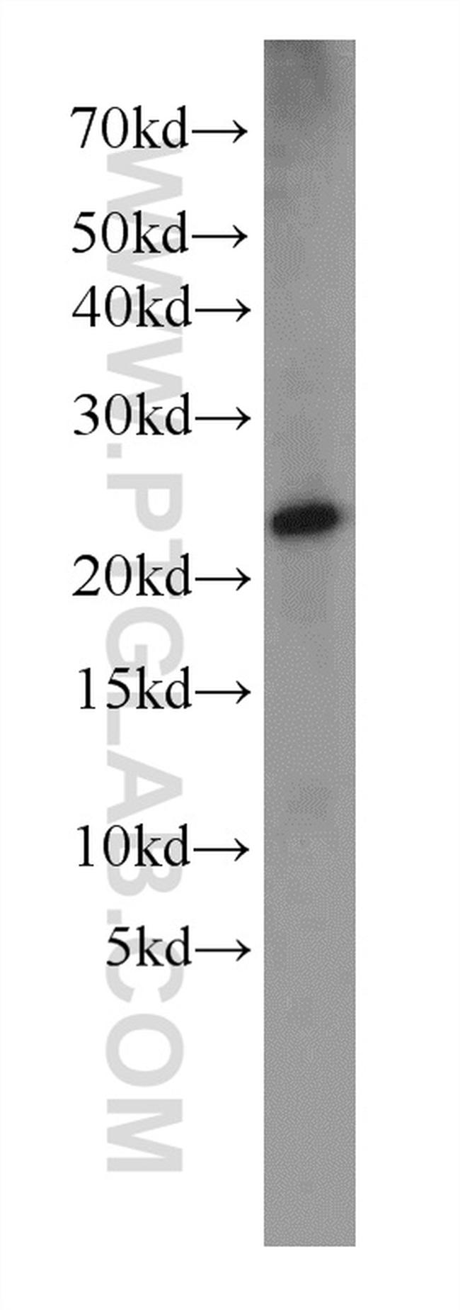 Dermatopontin Antibody in Western Blot (WB)