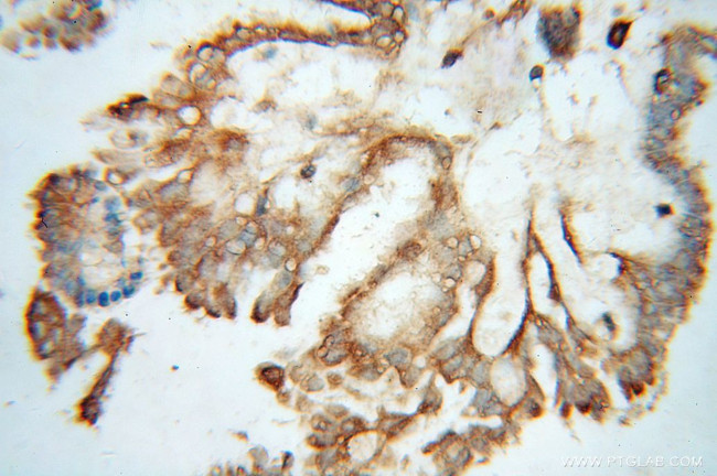 AIFM3 Antibody in Immunohistochemistry (Paraffin) (IHC (P))