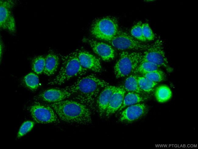 SMTNL2 Antibody in Immunocytochemistry (ICC/IF)