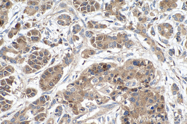 PCDHB10 Antibody in Immunohistochemistry (Paraffin) (IHC (P))