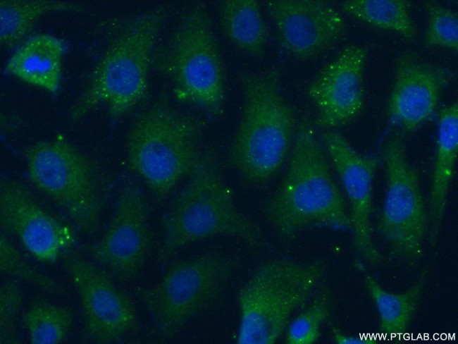 CAMKV Antibody in Immunocytochemistry (ICC/IF)