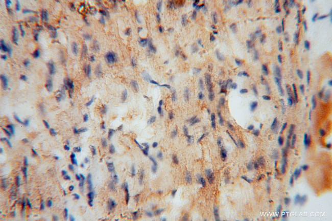 UQCR Antibody in Immunohistochemistry (Paraffin) (IHC (P))