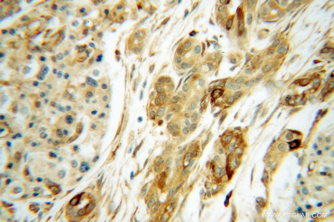RPS28 Antibody in Immunohistochemistry (Paraffin) (IHC (P))