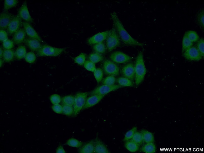 CRIP2 Antibody in Immunocytochemistry (ICC/IF)