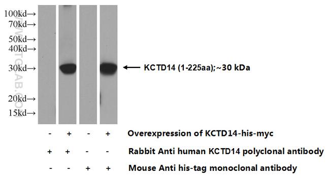 KCTD14 Antibody in Western Blot (WB)