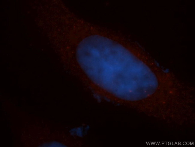 CCDC28A Antibody in Immunocytochemistry (ICC/IF)
