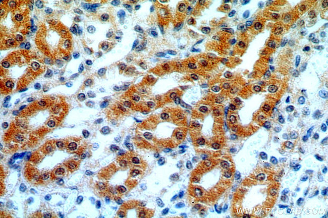Hikeshi Antibody in Immunohistochemistry (Paraffin) (IHC (P))