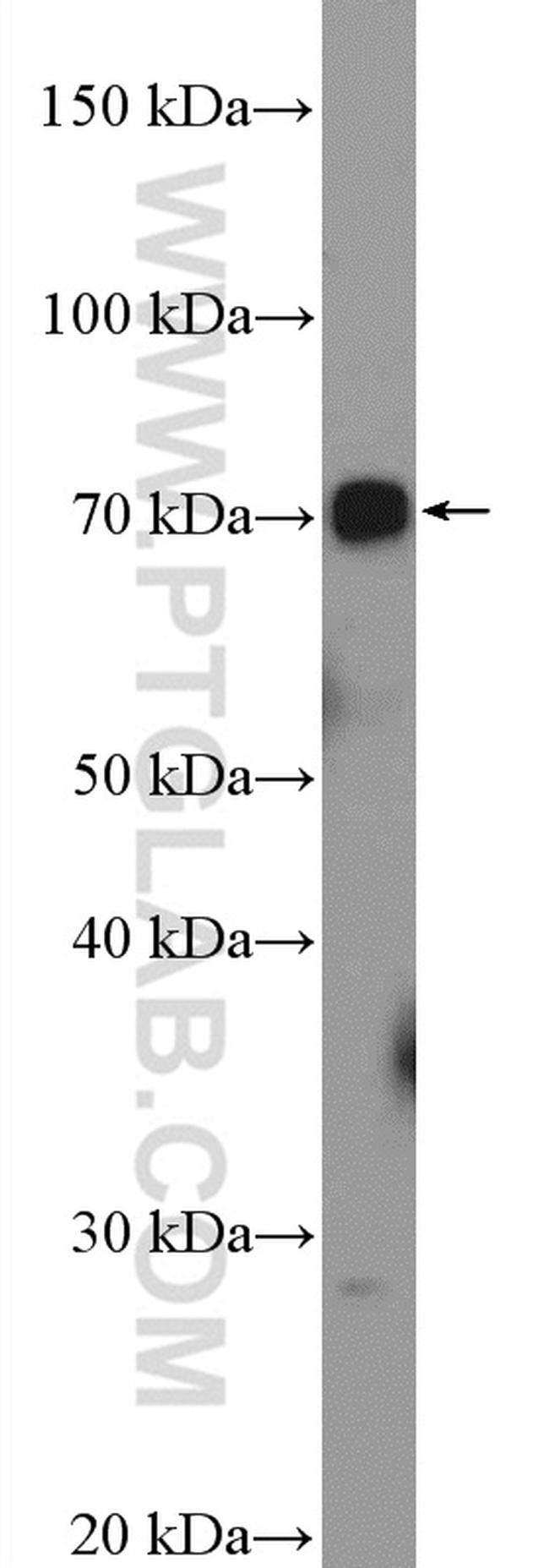 UBOX5 Antibody in Western Blot (WB)