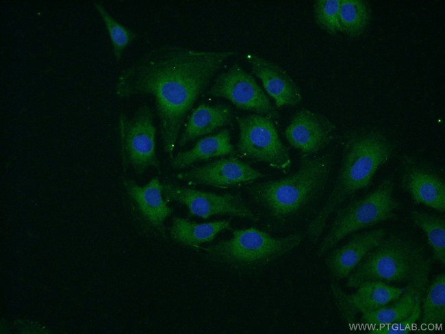 RPS24 Antibody in Immunocytochemistry (ICC/IF)