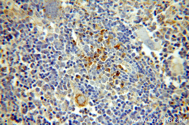 HMHA1 Antibody in Immunohistochemistry (Paraffin) (IHC (P))